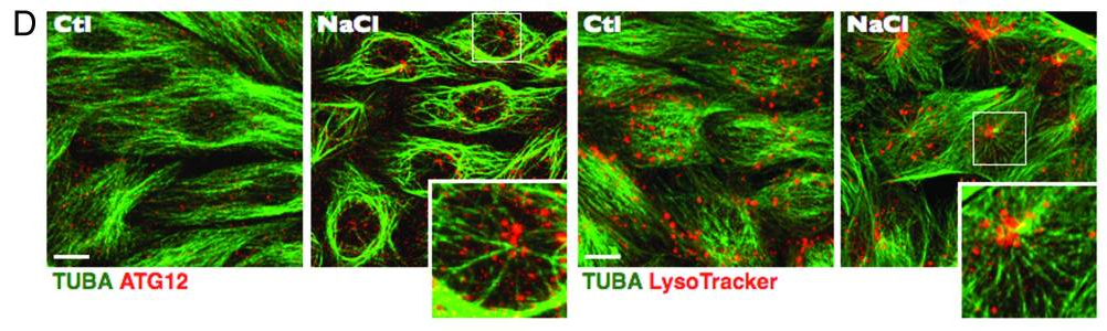 green stain for microtubules and red stain for ATG12 or Lysosome tracker