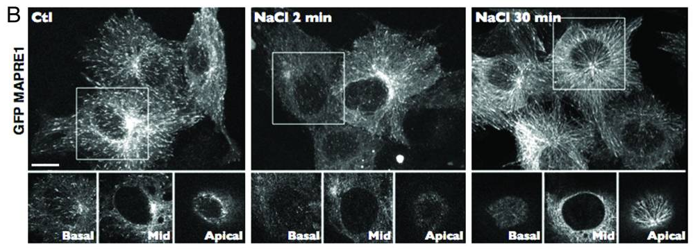 The Science Behind How Dry Fasting Reboots Your Autophagy and Fixes Your Cellular Health